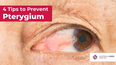 Prevent pterygium article header – First Aid Article in Chatswood